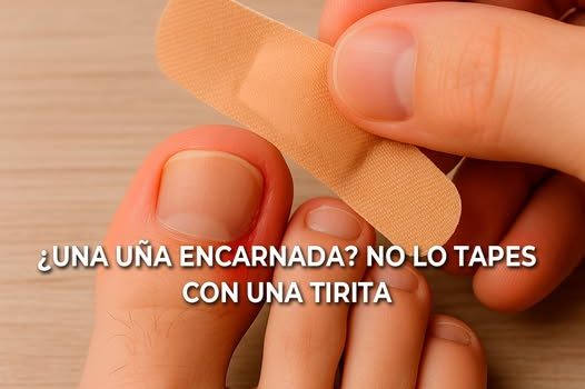 Uñas Encarnadas: Qué Son y Cómo un Podólogo Puede Tratarlas Uñas Encarnadas: Qué Son y Cómo un Podólogo Puede Tratarlas