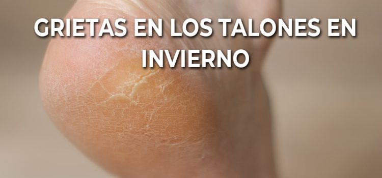 Grietas en los talones en invierno: ¿por qué aparecen y cómo tratarlas? Grietas en los talones en invierno: ¿por qué aparecen y cómo tratarlas?