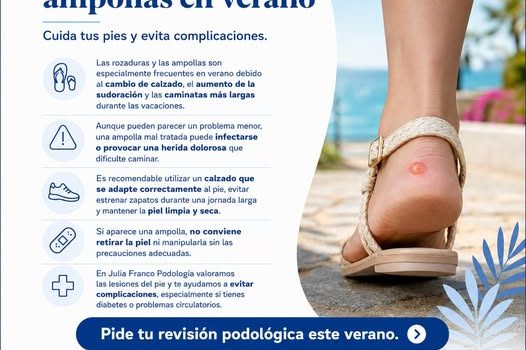 Rozaduras y ampollas de verano: cómo cuidar tus pies para disfrutar sin molestias